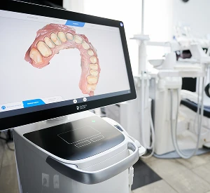 Digital Dental Scanners
